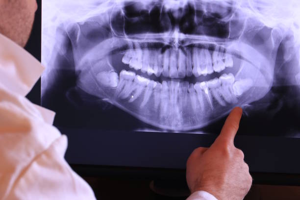 Best Emergency Dentist for Knocked-Out Tooth in La Nte, MO