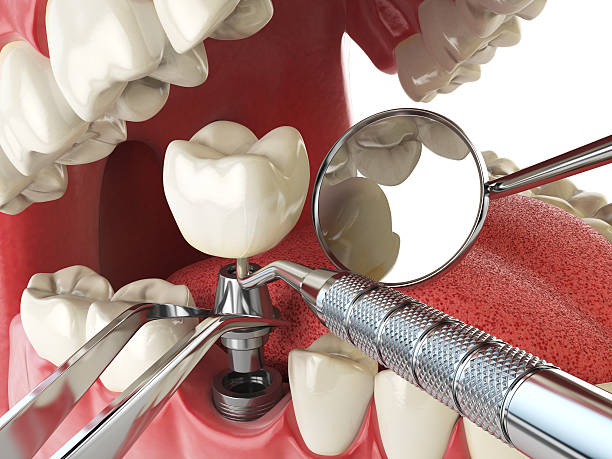 Best Pediatric Emergency Dentist in La Nte, MO